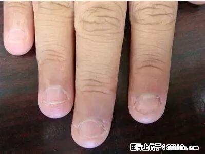 剪指甲、挖耳屎，这些日常小动作竟隐藏大危害！ - 克孜勒苏生活资讯 - 克孜勒苏28生活网 kzls.28life.net